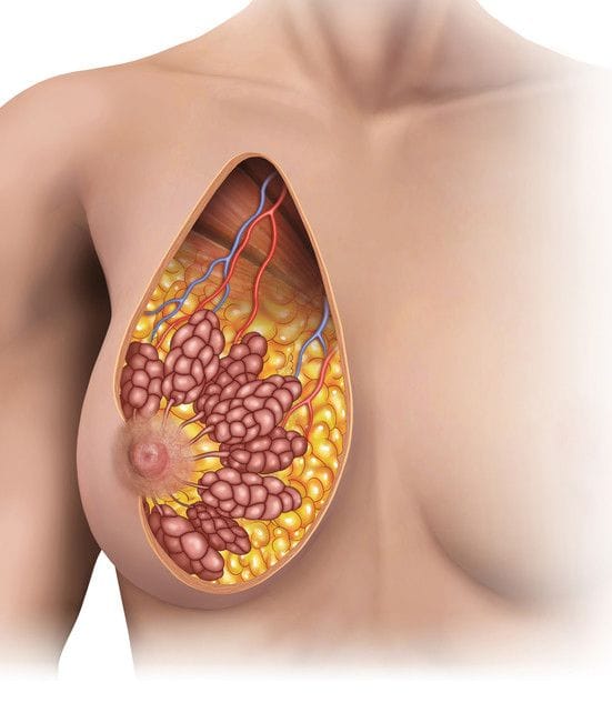 Your nipples and breast reduction Your nipples and breast reduction